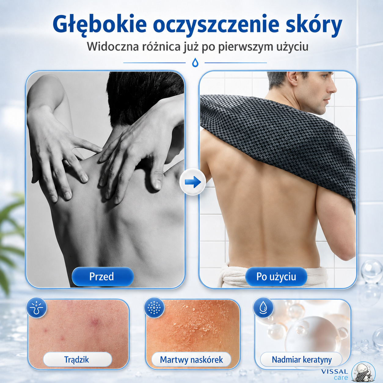 Skóra po kąpieli dalej wydaje się szorstka? Vissal pomaga ją lepiej oczyścić już pod prysznicem